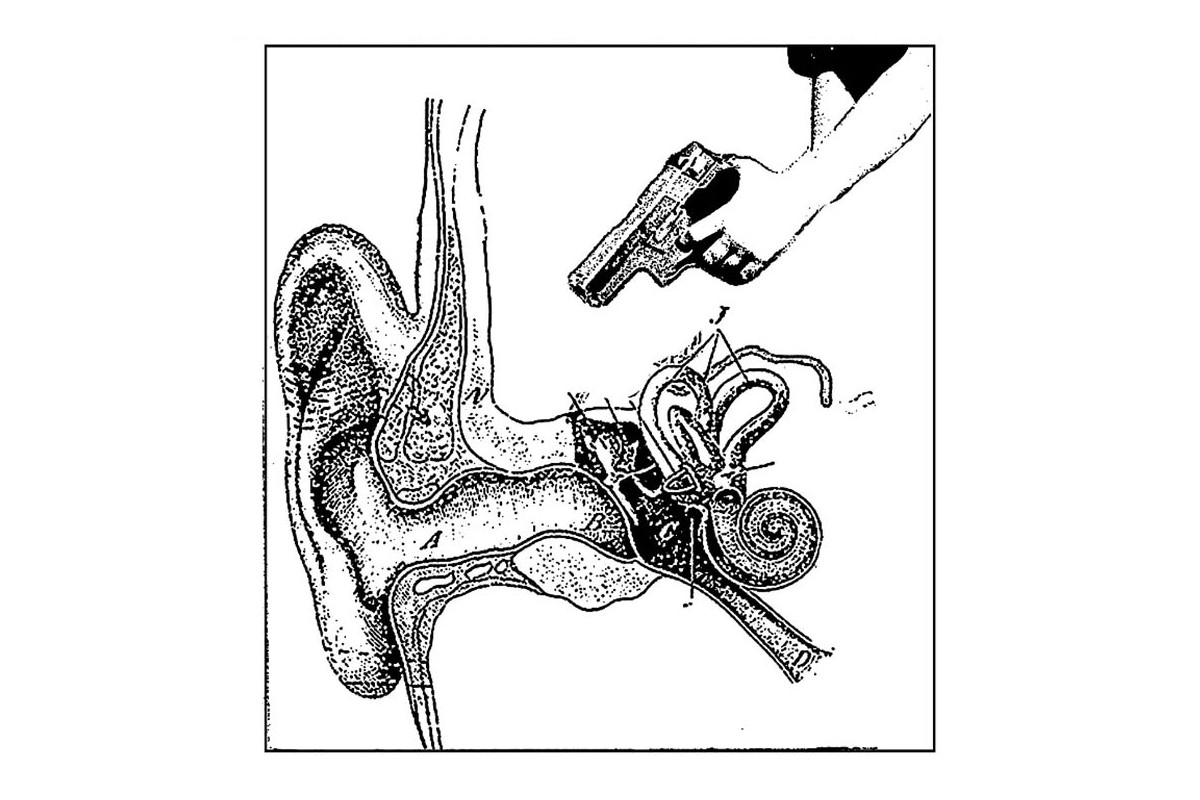More Noise Please! Presents Static / Dissonance / Rhythm / Eruption